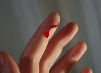 Mơ bị đứt tay đánh con đề gì mang lại nhiều tài lộc?