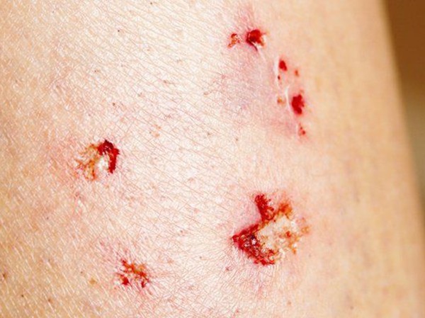 Nằm mơ thấy bị chó cắn là điềm gì, báo mộng xui hay hên?